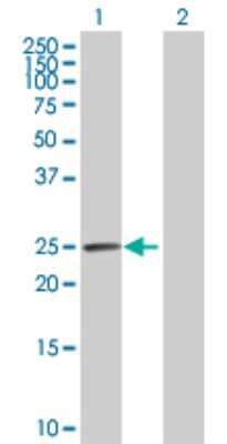 Western Blot: Carbonic Anhydrase I/CA1 Antibody [H00000759-D01P]