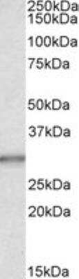 Western Blot: Carbonic Anhydrase I/CA1 Antibody [NBP1-36740]