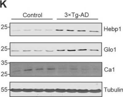 Western Blot: Carbonic Anhydrase I/CA1 Antibody [NBP1-88191]