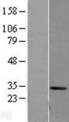 Western Blot: Carbonic Anhydrase I/CA1 Overexpression Lysate [NBL1-08609]