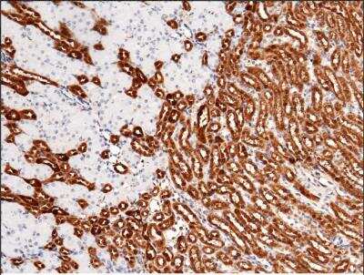 Immunohistochemistry-Paraffin: Carbonic Anhydrase II/CA2 Antibody (003) [NBP2-90677]