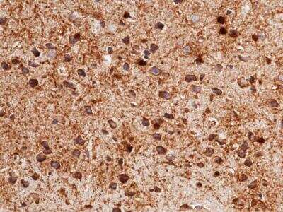 Immunohistochemistry-Paraffin: Carbonic Anhydrase II/CA2 Antibody (003) [NBP2-90677]