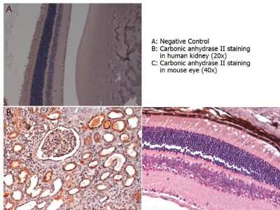 Immunohistochemistry: Carbonic Anhydrase II/CA2 Antibody [NB600-919]