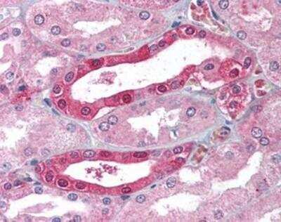 Immunohistochemistry-Paraffin: Carbonic Anhydrase II/CA2 Antibody - BSA Free [NB100-80863]