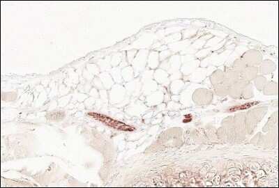 Immunohistochemistry-Paraffin: Carbonic Anhydrase II/CA2 Antibody [NB600-919]