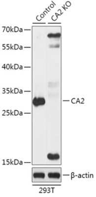 Knockout Validated: Carbonic Anhydrase II/CA2 Antibody - Azide and BSA Free [NBP3-03387]