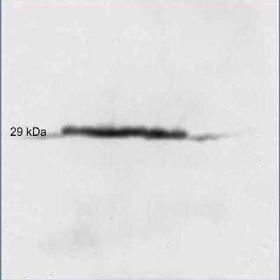 Western Blot: Carbonic Anhydrase II/CA2 Antibody [NB600-919]
