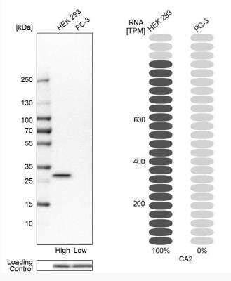 Western Blot: Carbonic Anhydrase II/CA2 Antibody [NBP2-52736]