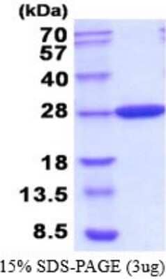 SDS-PAGE: Recombinant E. coli Carbonic Anhydrase II/CA2 His Protein [NBP2-52240]