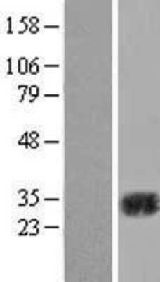 Western Blot: Carbonic Anhydrase II/CA2 Overexpression Lysate [NBL1-08615]