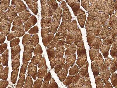 Immunohistochemistry-Paraffin: Carbonic Anhydrase III/CA3 Antibody (002) [NBP2-89537]