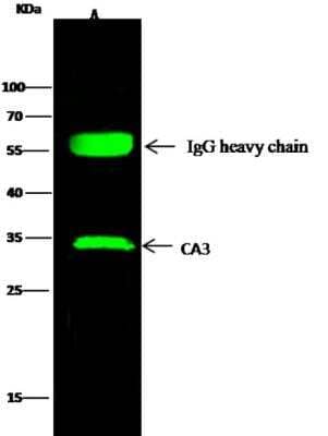 Immunoprecipitation: Carbonic Anhydrase III/CA3 Antibody (006) [NBP2-89538]