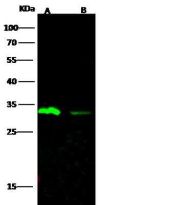 Western Blot: Carbonic Anhydrase III/CA3 Antibody (006) [NBP2-89538]