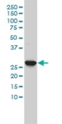 Western Blot: Carbonic Anhydrase III/CA3 Antibody (4A12-1A3) [H00000761-M02]