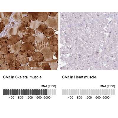 Immunohistochemistry-Paraffin: Carbonic Anhydrase III/CA3 Antibody [NBP1-88227]