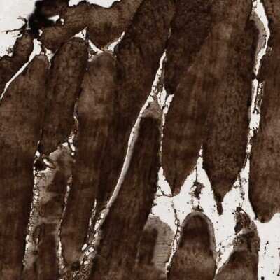 Immunohistochemistry-Paraffin: Carbonic Anhydrase III/CA3 Antibody [NBP1-88228]