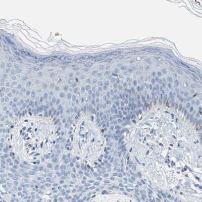Immunohistochemistry-Paraffin: Carbonic Anhydrase III/CA3 Antibody [NBP1-88228]
