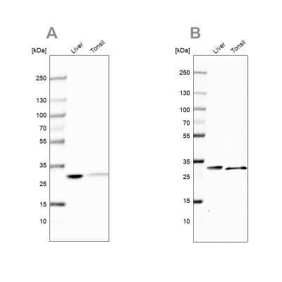 Western Blot: Carbonic Anhydrase III/CA3 Antibody [NBP1-88228]