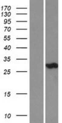 Western Blot: Carbonic Anhydrase III/CA3 Overexpression Lysate [NBL1-08616]