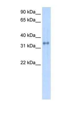 Western Blot: Carbonic Anhydrase IV/CA4 Antibody [NBP1-69435]