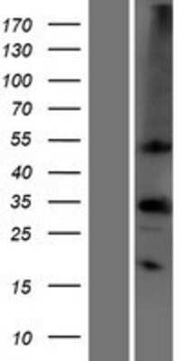 Western Blot: Carbonic Anhydrase IV/CA4 Overexpression Lysate [NBP2-10691]