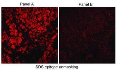 Immunohistological Detection of Carbonic Anhydrase IX/CA9 in Human RCC Tumor Cryosections