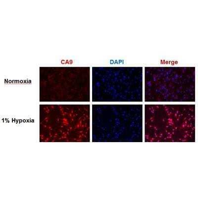 Immunofluorescent Staining of Carbonic Anhydrase IX/CA9 in Human Glioma U87 Cells