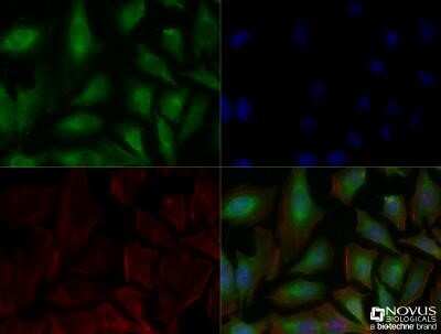 Immunocytochemistry/ Immunofluorescence: Carbonic Anhydrase IX/CA9 Antibody (2D3) - Azide and BSA Free [NBP2-80611]