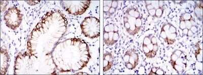 Immunohistochemistry-Paraffin: Carbonic Anhydrase IX/CA9 Antibody (2D3) - Azide and BSA Free [NBP2-80611]