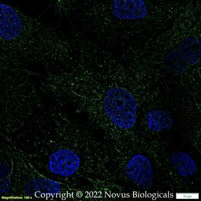 Immunocytochemistry/ Immunofluorescence: Carbonic Anhydrase IX/CA9 Antibody (2D3) - BSA Free [NBP1-51691]