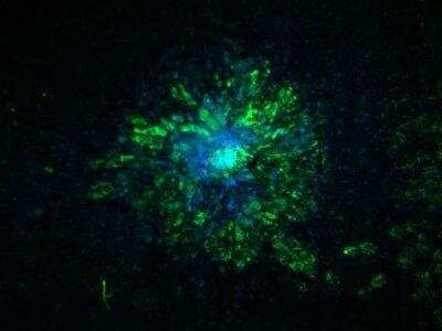 Immunocytochemistry/ Immunofluorescence: Carbonic Anhydrase IX/CA9 Antibody (2D3) - BSA Free [NBP1-51691]