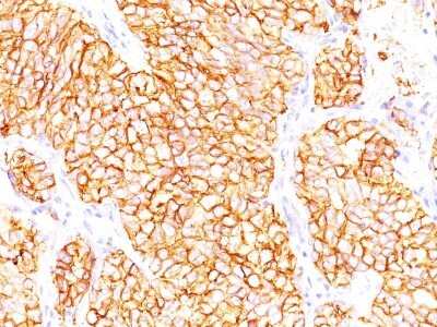 Immunohistochemistry-Paraffin: Carbonic Anhydrase IX/CA9 Antibody (66.4.C2 (PN-15)) - Azide and BSA Free [NBP2-33152]