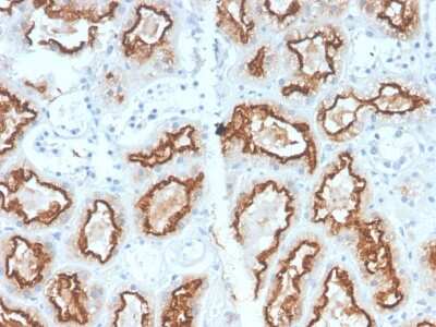 Immunohistochemistry-Paraffin: Carbonic Anhydrase IX/CA9 Antibody (CA9/2993R) - Azide and BSA Free [NBP3-08407]