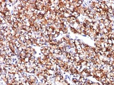 Immunohistochemistry-Paraffin: Carbonic Anhydrase IX/CA9 Antibody (CA9/781) [NBP2-45237]