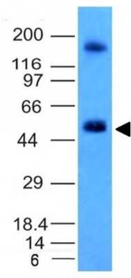 Western Blot: Carbonic Anhydrase IX/CA9 Antibody (CA9/781) [NBP2-45237]