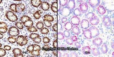 Dual RNAscope ISH-IHC Analysis of Carbonic Anhydrase IX/CA9 in Paraffin Embedded Human Stomach