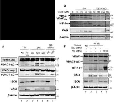 Western Blot Detection of Carbonic Anhydrase IX/CA9 in HeLa Cells Under Multiple Conditions and Treatments