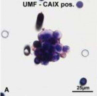 Staining of Carbonic Anhydrase IX/CA9 in CNHCs