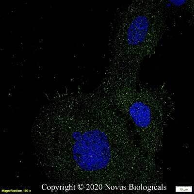 Immunocytochemistry/Immunofluorescence Staining of Carbonic Anhydrase IX/CA9 in A431 Cells