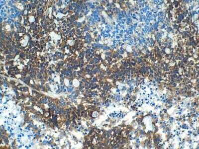 Immunohistochemical Staining of Carbonic Anhydrase IX/CA9 in Frozen Mouse Xenografted Human Colon Carcinoma