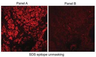 Immunohistological Detection of Carbonic Anhydrase IX/CA9 in Human RCC Tumor Cryosections