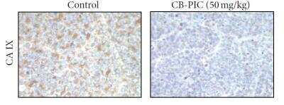 Immunohistochemical Staining of Carbonic Anhydrase IX/CA9 in Control and CB-PIC Treated Colorectal Cancer