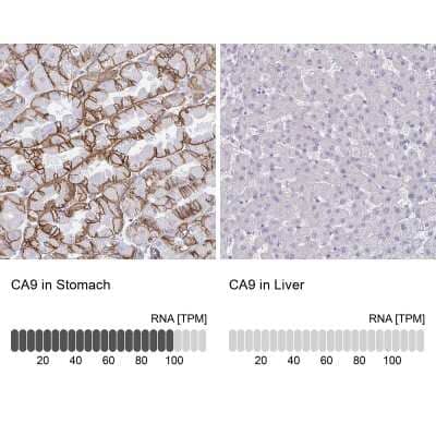 Immunohistochemistry-Paraffin: Carbonic Anhydrase IX/CA9 Antibody [NBP2-54743]