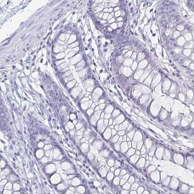 Immunohistochemistry-Paraffin: Carbonic Anhydrase IX/CA9 Antibody [NBP2-54743]