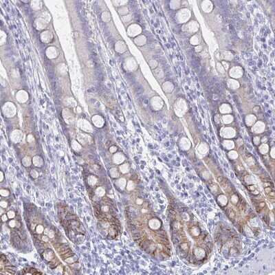 Immunohistochemistry-Paraffin: Carbonic Anhydrase IX/CA9 Antibody [NBP2-54743]