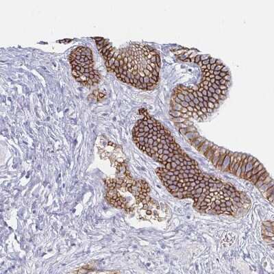 Immunohistochemistry-Paraffin: Carbonic Anhydrase IX/CA9 Antibody [NBP2-54743]