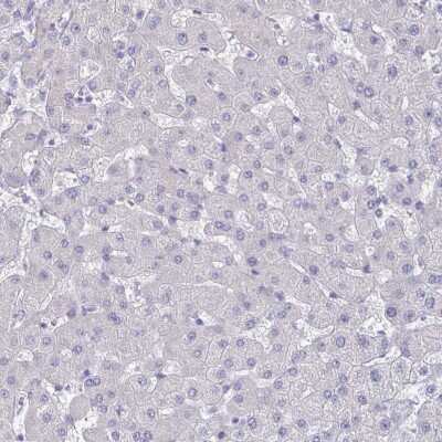 Immunohistochemistry-Paraffin: Carbonic Anhydrase IX/CA9 Antibody [NBP2-54743]