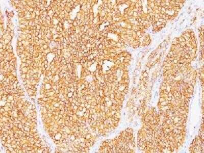 Immunohistochemistry-Paraffin: Carbonic Anhydrase IX/CA9 Antibody (SPM487) - Azide and BSA Free [NBP2-34411]