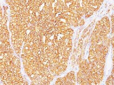 Immunohistochemistry-Paraffin: Carbonic Anhydrase IX/CA9 Antibody (SPM487) [NBP2-34363]