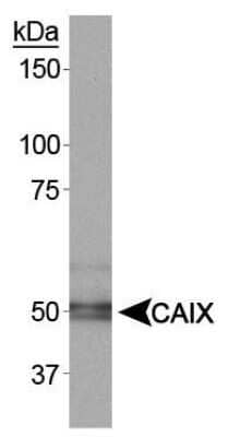 Detection of Carbonic Anhydrase IX/CA9 in Rat Renal Cortex by Western Blot